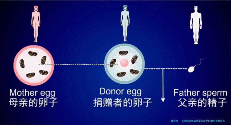 美国ENCI做试管婴儿的全部费用大概是多少钱？