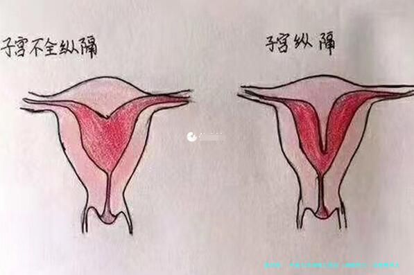 中南大学湘雅三医院（湘雅附三）试管费用大概要多少钱？