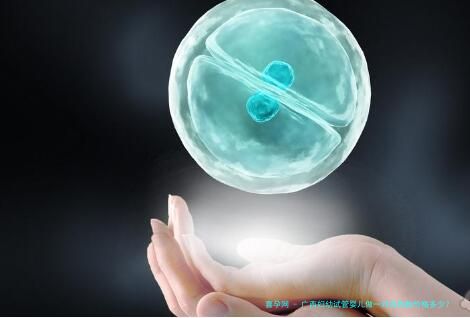 广西妇幼试管婴儿做一对双胞胎价格多少？