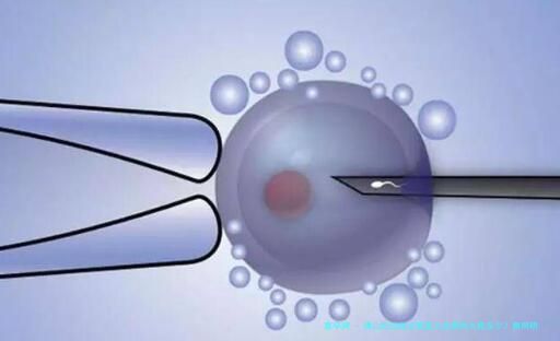 佛山妇幼做试管婴儿的费用大概多少？费用明细是怎么样的？