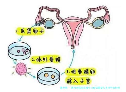 涿州市医院生殖中心做试管婴儿各环节如何收费？