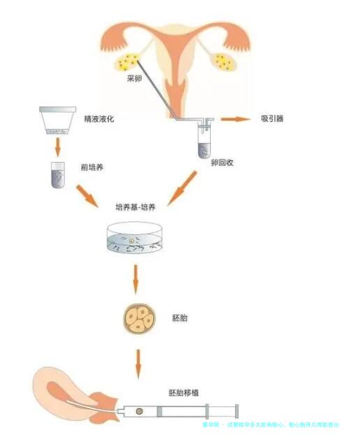 试管助孕多久能有胎心，胎心胎芽几周能查出来